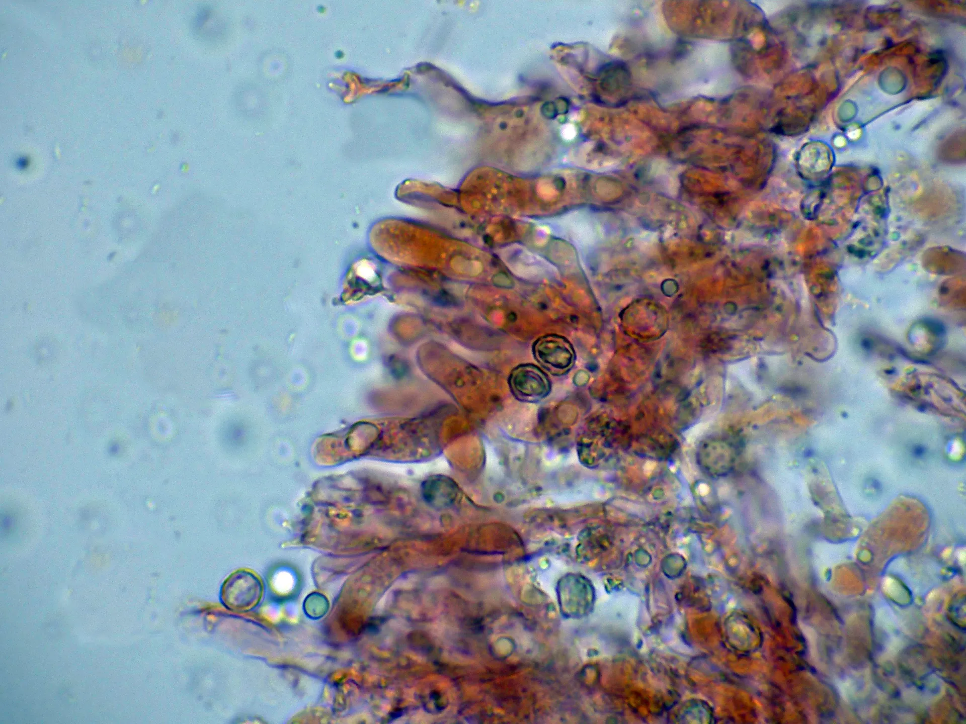 Microscopía de Lenzitopsis oxycedri - 10 - Himenio-002